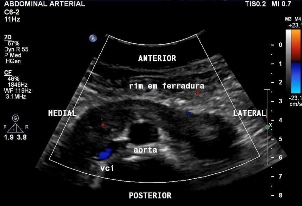 Marcos A. P. Borges, MD 🇧🇷 tweet media