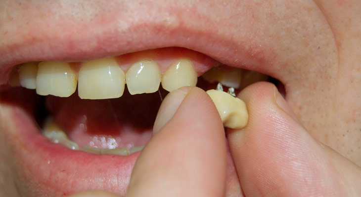 dental_canada's tweet photo. While a #DentalImplant has many benefits, sometimes they can fall out or become loose.⚠️ Check out this new guideline to see what the appropriate actions are to take if this happens to you.🩺🦷

🌍 Read More: https://t.co/GLA8QSaUX1

#TorontoDentalImplant #TorontoDental #Toronto https://t.co/aQrR9nHii2