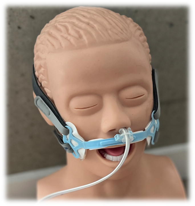 HatchMedical's tweet photo. NG Guard™ provides external securement designed to prevent feeding tube dislodgment for up to 29 days.

Issued IP and Class II FDA exempt, available for distribution, license or acquisition through Hatch Medical.

https://t.co/RZGdkBriVD

#hatchmedical #makingadifference https://t.co/08ywrl3NKJ