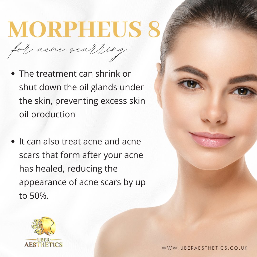 Uberaesthetics1's tweet photo. MORPHEUS 8
#Mesotheraphy #hifu #Ultherapy #acnetreatment
#microneedling #Hydrafacial #fatdissolvinginjections
#Aqualyx #prphairloss #8pointfacelift #Jawfiller
#cheekfiller #nonsurgicalbrazilianbuttlift #hyderafacial #morpheus8 #bumlift #lasergenesis #Botox #hairremoval #cheshire https://t.co/MUISEqwnLG