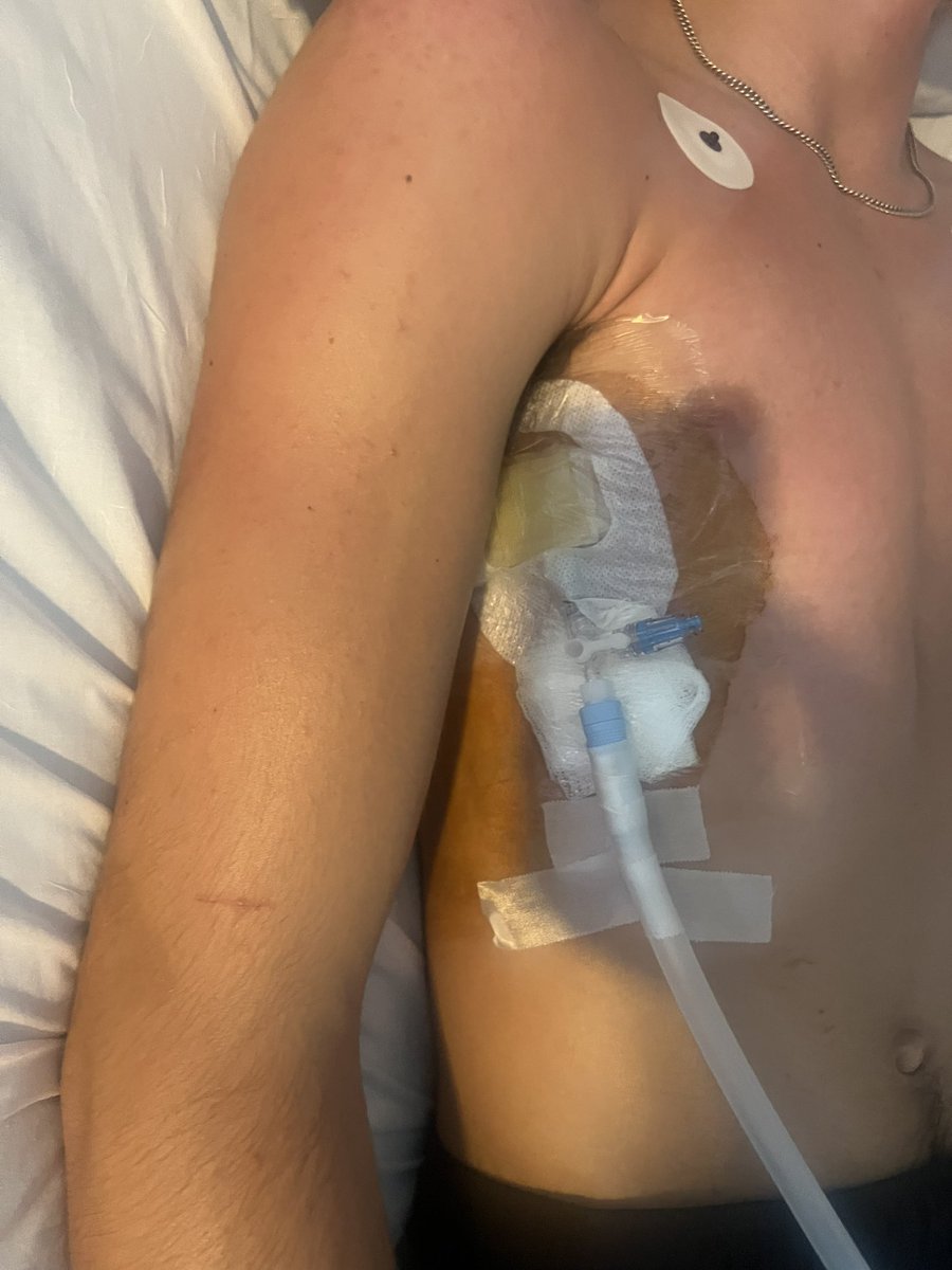 Colton Harrison (@coco_harrison05) on Twitter photo Please continue to pray for <a href="/Ryder_H2026/">Ryder_Harrison2026</a>. Doctors removed his original chest tube, but unfortunately had to put another one in when his lung began to collapse again. He is still in Driscoll Children’s Hospital. <a href="/GPWildcatsFB/">Gregory-Portland Fighting Wildcat Football</a> <a href="/KevinHa66908237/">VAULT BARN</a> <a href="/GPHSwildcats1/">Gregory-Portland High School</a> Please continue to pray for <a href="/Ryder_H2026/">Ryder_Harrison2026</a>. Doctors removed his original chest tube, but unfortunately had to put another one in when his lung began to collapse again. He is still in Driscoll Children’s Hospital. <a href="/GPWildcatsFB/">Gregory-Portland Fighting Wildcat Football</a> <a href="/KevinHa66908237/">VAULT BARN</a> <a href="/GPHSwildcats1/">Gregory-Portland High School</a>