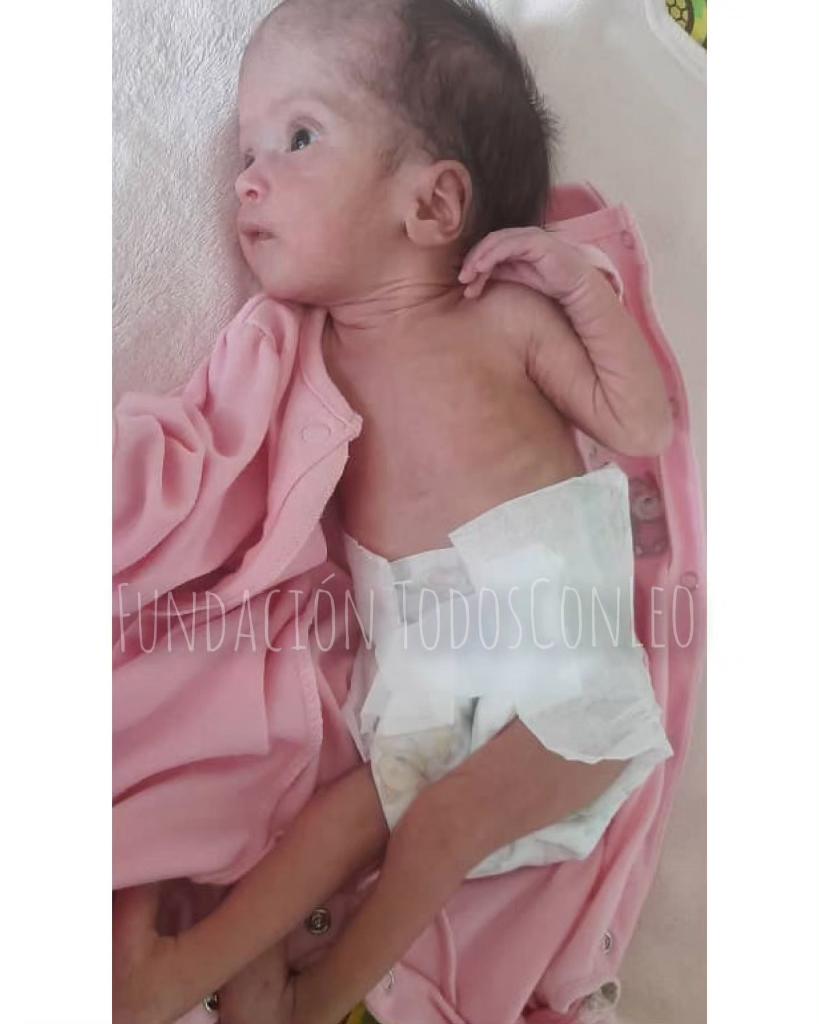 TodosConLeo's tweet photo. Gleis Urbina 25 días de nacida 🥺🙏🏻
Dx: Hidrocefalia No Comunicante amerita URGENTE Válvula Neonatal Presión Media 🙏🏻🆘 el costo es de 200$

Para Donaciones 👇

🅿️PayPal todosconleovzla@gmail.com

📲 Cuenta Corriente, Banco 100% 
01560009820100698273 TODOSCONLEO
RIF J408423324 https://t.co/DyjJKjkZpw