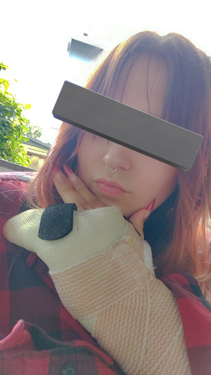 123nullandvoid's tweet photo. Am I still cute with a broken hand~? ｡⁠:ﾟ⁠(⁠;⁠´⁠∩⁠`⁠;⁠)ﾟ⁠:⁠｡

#nsfwtwt #nsfwacc #submissive #horny #cumslut #brat #cnc #traumakink https://t.co/9b25d1METl