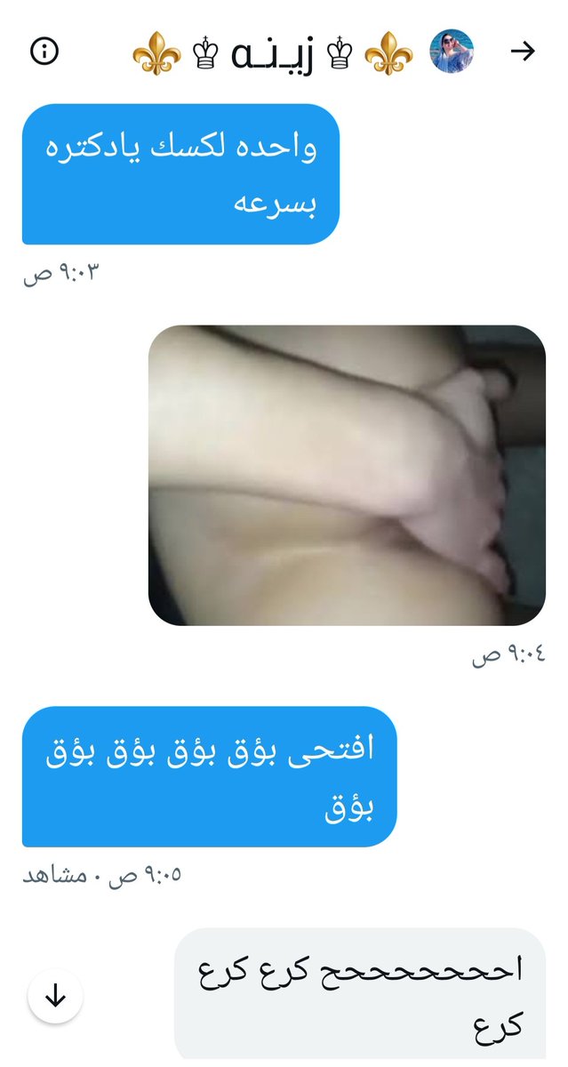 صبآاح التفاح لعيون ست الملاح زينه الدكتره 😋🖕👙 واجمد دلععع @ZR______H