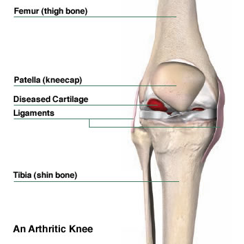 UniversalSurge1's tweet photo. Total #Knee #Replacement #Surgery: Tips For Maximising Lifespan Of #Implants And Prevent Revision #Surgeries 
Read more: https://t.co/IcUy2o04z4 
share your paper on: https://t.co/7f9IQq9XFt 
#ipjus 
#manuscript 
#reseach 
#Implants #Surgery https://t.co/ZkiAkbewj9