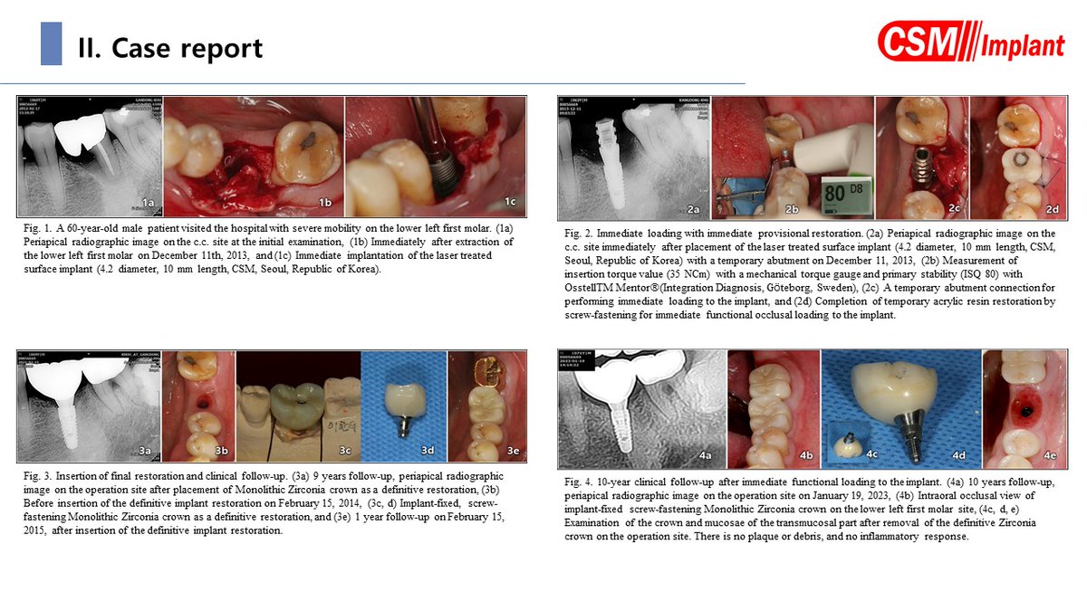 csmimplant's tweet photo. We would like to share the thesis written by Richard Sungbok Lee using our product #dentalimplants #implants #thesis #manufacturing #manufacturerkorea https://t.co/0B3mUQiYgp