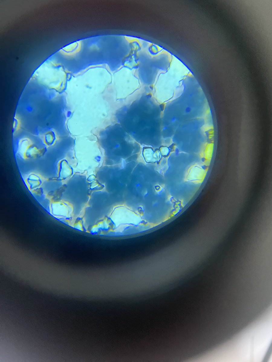 oki_lsiak's tweet image. Identify the parasite seen in this field 
#MLSCommunity