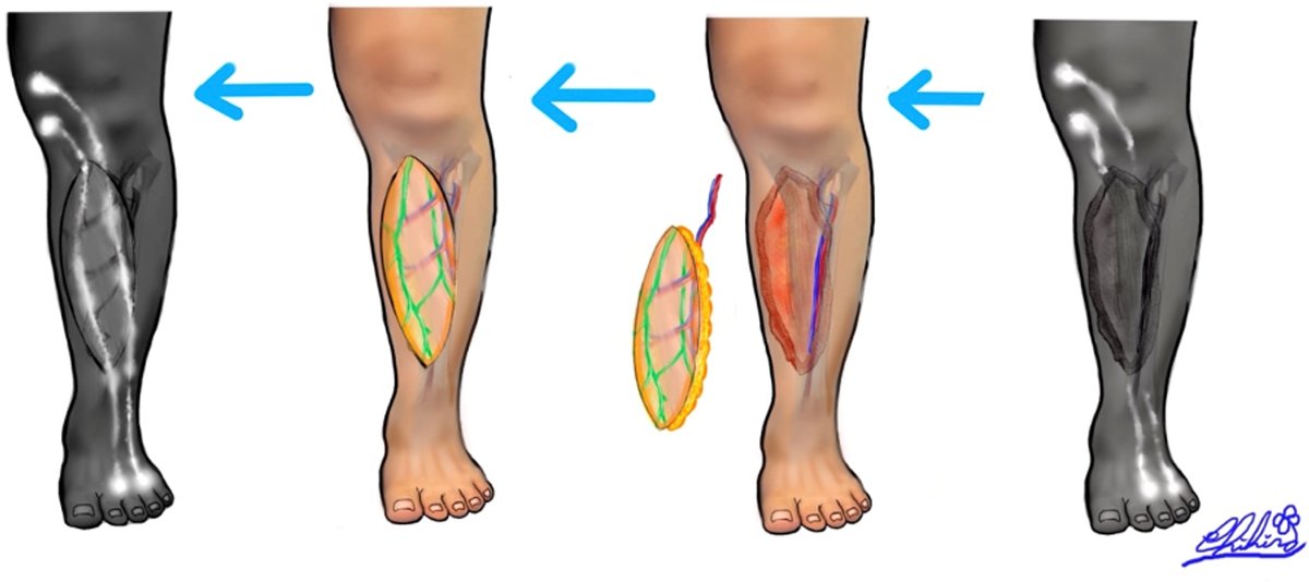 Plast Aesthet Res tweet media