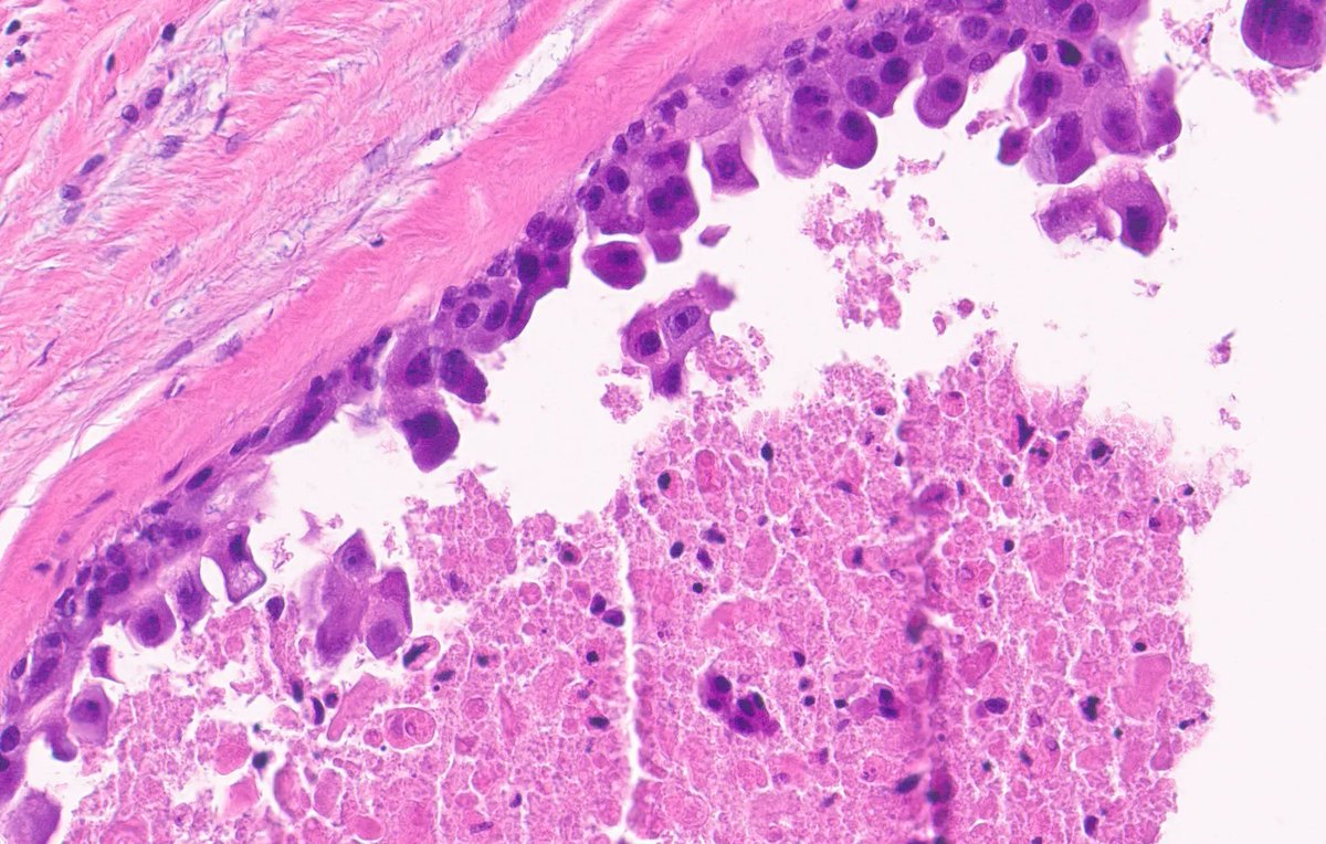 kiko4docs's tweet image. What is that? 
Answer: kikoxp.com/posts/15048 
More posts from Dr. Rey @ReyPathology kikoxp.com/severino_rey1
#pathology #pathTwitter #medTwitter
