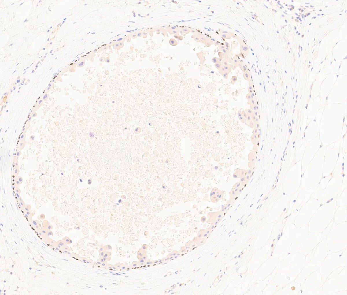 kiko4docs's tweet image. What is that? 
Answer: kikoxp.com/posts/15048 
More posts from Dr. Rey @ReyPathology kikoxp.com/severino_rey1
#pathology #pathTwitter #medTwitter