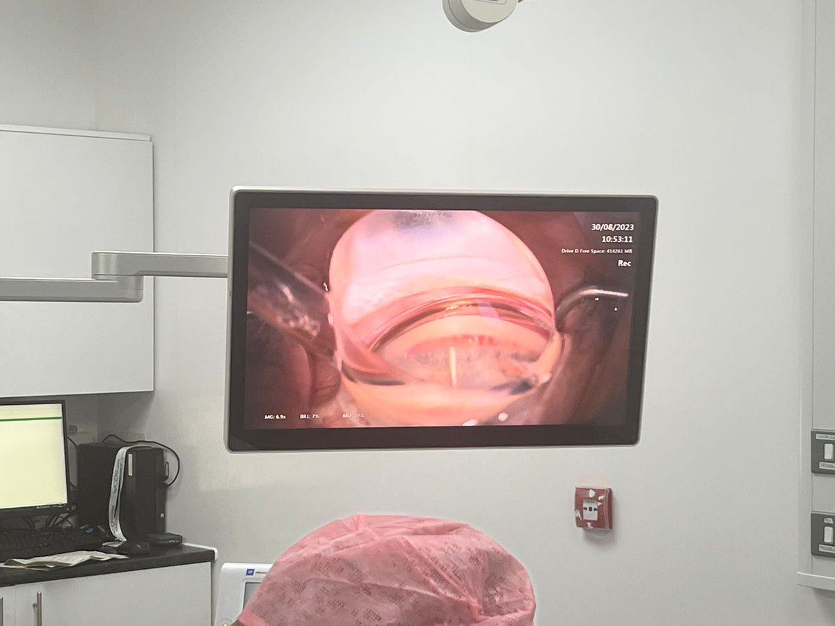 elios_vision's tweet photo. Elios Vision were honoured to be invited to Colchester today to support the first Elios procedures by Mr Chrys Dimitriou
#EliosVision #Elios
https://t.co/oeklNBkWaA
ELIOS is not approved for sale in the United States, where it is limited by Federal law to investigational use. https://t.co/NPWSxS10kz
