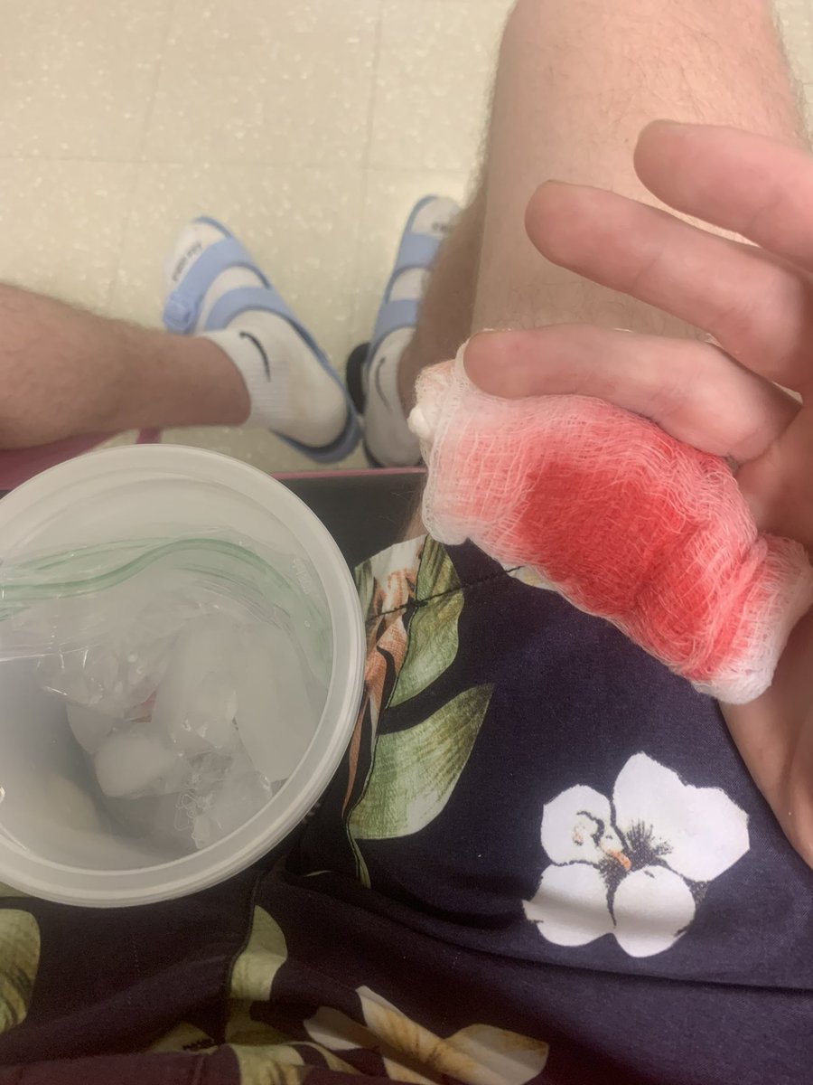 sadskateboy's tweet photo. it has officially been one year since i’ve lost my pinky :,-) https://t.co/0KB2Rn5ZzX