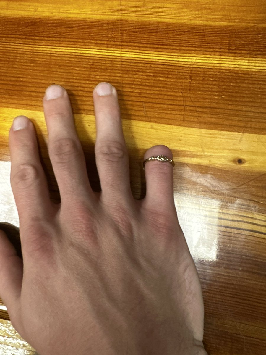 sadskateboy's tweet photo. it has officially been one year since i’ve lost my pinky :,-) https://t.co/0KB2Rn5ZzX