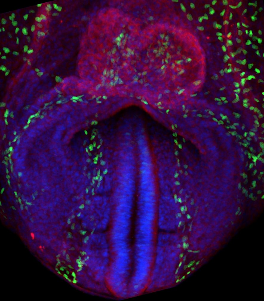 🔬 Join CNIC's team! Seeking motivated Master's grad for 4y predoctoral contract in Miguel Torres' group
🌟 Explore cardiac development with live microscopy, image analysis, and computer modeling.
📆 Apply by Sept 30 📧 mtorres@cnic.es
#ResearchOpportunity #CardiacDevelopment