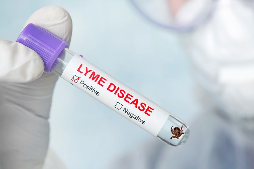 andalmanflynn's tweet photo. If you have Lyme disease and are unable to work, we can help! Contact us to speak with an experienced disability benefits lawyer on our team, and we’ll do everything we can to maximize your chances of success. https://t.co/5pUjb0FuxN

 #lymedisease #disabilitybenefitslaw https://t.co/pWfsABlwcH