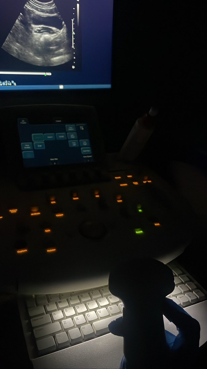 xtooni1's tweet photo. My first scan in ultrasound 🩵☢️ https://t.co/o8owDeQ90E