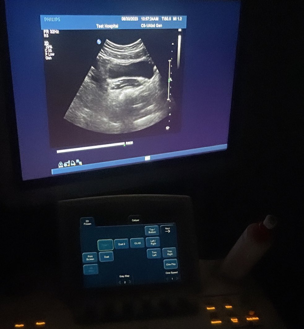 xtooni1's tweet photo. My first scan in ultrasound 🩵☢️ https://t.co/o8owDeQ90E