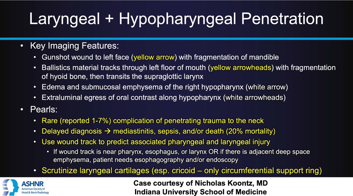 #ASHNRCOTW #226 ANSWER: Laryngeal + hypopharyngeal penetration! Thx <a href="/nakoontz/">Nicholas Koontz</a> <a href="/IURadiology/">IU Radiology and Imaging Sciences</a> 4 case! #ASHNR23

<a href="/AshokSrini15/">Ashok Srinivasan</a> <a href="/nancyfstanford/">Nancy Fischbein</a> <a href="/callyrobs/">Caroline Robson, MBChB</a> <a href="/kmmosier/">Kristine Mosier</a> <a href="/DShatzkes/">Deborah Shatzkes</a> <a href="/CDP_Rad/">C Douglas Phillips 🇺🇸</a> <a href="/rhwiggins/">Richard Wiggins</a> <a href="/cmtomblinson/">Courtney Tomblinson, MD</a> <a href="/WmOBrienDO/">William T. O'Brien, DO 🧠🩻</a> <a href="/ESHNRSociety/">ESHNR</a> <a href="/TheASNR/">The American Society of Neuroradiology</a> <a href="/CMGlastonbury/">Christine M Glastonbury, MD</a> <a href="/tabby_kennedy/">Tabby A. Kennedy, MD</a> <a href="/RadRupa/">Rupa Radhakrishnan</a>