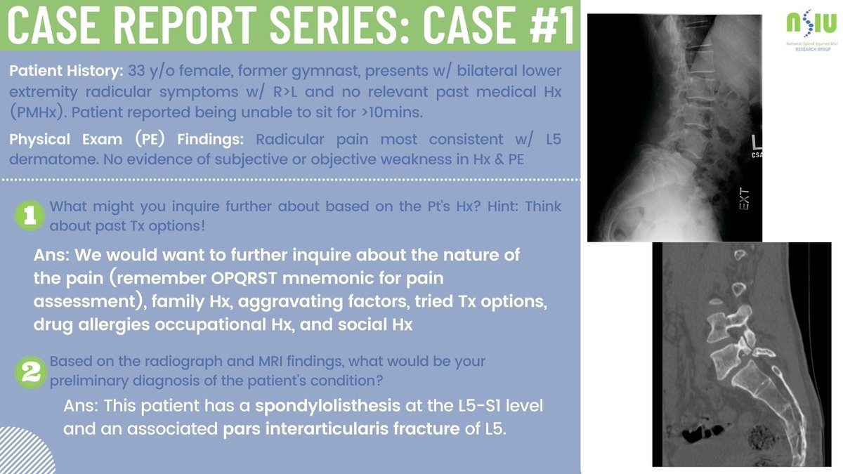 1st case solved! 1) Always consider prior Tx before surgery. Explore pain details (remember OPQRST mnemonic: Onset, Provocation, Quality, Radiation, Severity, Timing). Always go back to the Pt's family Hx! 2) Dx: Spondylolisthesis at L5-S1 & pars fracture of L5.