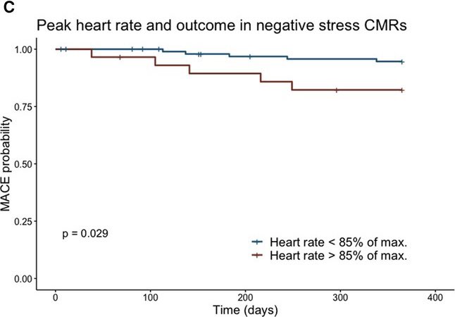 weberlingld's tweet photo. 176 patients (49 women), 156 of those on permanent dialysis.
Dobutamine stress is:
- safe (1 major complication, 0.6%)
- accurate (PPV 92.6%, NPV 95%)
- predicts prognosis: ⬇️LV-EF and inability to reach peak stress (despite max stimulation) predict poor prognosis https://t.co/47ZJh42v85