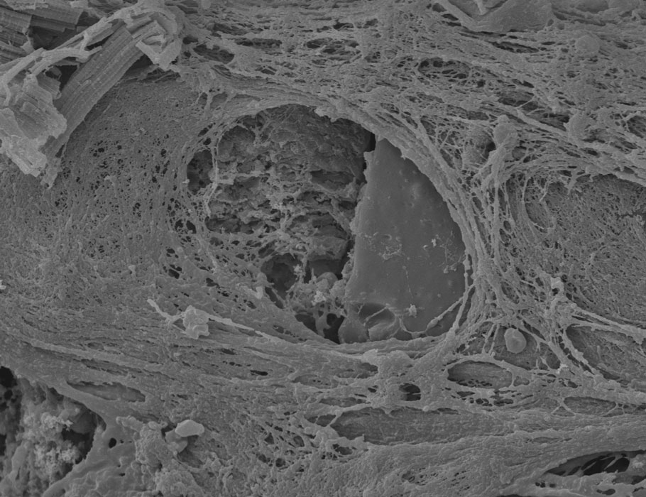 Science Robotics (@scirobotics) on Twitter photo A smart #SoftRobotics system tackles a key hurdle for long-term drug delivery via medical devices: fibrotic tissue buildup and obstruction of drugs.
Study by <a href="/Lu_Schreiber1/">Lucien Schreiber</a> <a href="/gduffy00/">Garry P. Duffy</a> <a href="/ellentroche/">Ellen Roche MIT</a> and colleagues: scim.ag/3UA
Focus: scim.ag/3UB A smart #SoftRobotics system tackles a key hurdle for long-term drug delivery via medical devices: fibrotic tissue buildup and obstruction of drugs.
Study by <a href="/Lu_Schreiber1/">Lucien Schreiber</a> <a href="/gduffy00/">Garry P. Duffy</a> <a href="/ellentroche/">Ellen Roche MIT</a> and colleagues: scim.ag/3UA
Focus: scim.ag/3UB