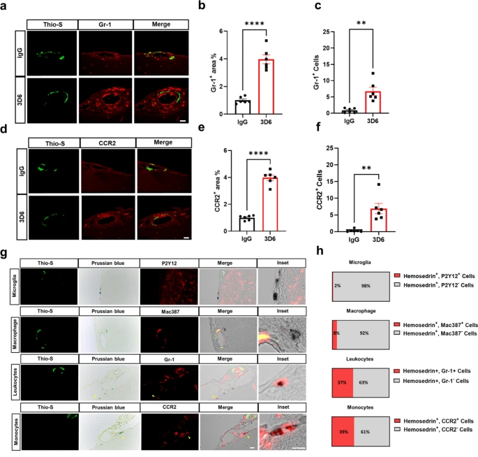 Molecular Neurodegeneration (@molneuro) on Twitter photo '#Amyloid-β (Aβ) immunotherapy induced #microhemorrhages are associated with activated #perivascular #macrophages and peripheral monocyte recruitment in #AlzheimersDisease mice'
<a href="/XavierTaylorPhD/">Xavier Taylor, Ph.D.</a>... Ronald B. DeMattos, Yaming Wang, Feng Pan <a href="/EliLillyandCo/">Eli Lilly and Company</a>
…arneurodegeneration.biomedcentral.com/articles/10.11… '#Amyloid-β (Aβ) immunotherapy induced #microhemorrhages are associated with activated #perivascular #macrophages and peripheral monocyte recruitment in #AlzheimersDisease mice'
<a href="/XavierTaylorPhD/">Xavier Taylor, Ph.D.</a>... Ronald B. DeMattos, Yaming Wang, Feng Pan <a href="/EliLillyandCo/">Eli Lilly and Company</a>
…arneurodegeneration.biomedcentral.com/articles/10.11…
