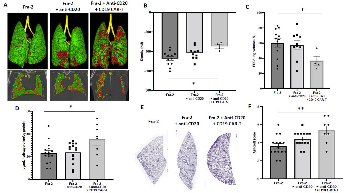 Preclinical data suggest caution when applying CD19-targeted CAR-T cells in patients with systemic sclerosis with associated interstitial lung disease

In A&amp;R
loom.ly/lJUpn3I
by <a href="/AvouacJerome/">Avouac Jérôme</a> et al

Image: CD19 CAR-T cells worsen lung fibrosis in Fra-2 Tg mice