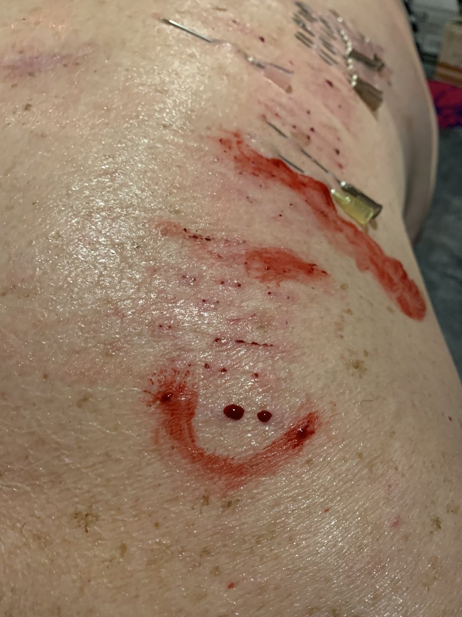 Okay my stabbing friends - what’s your favorite *unexpected* item in your sharps kit…?