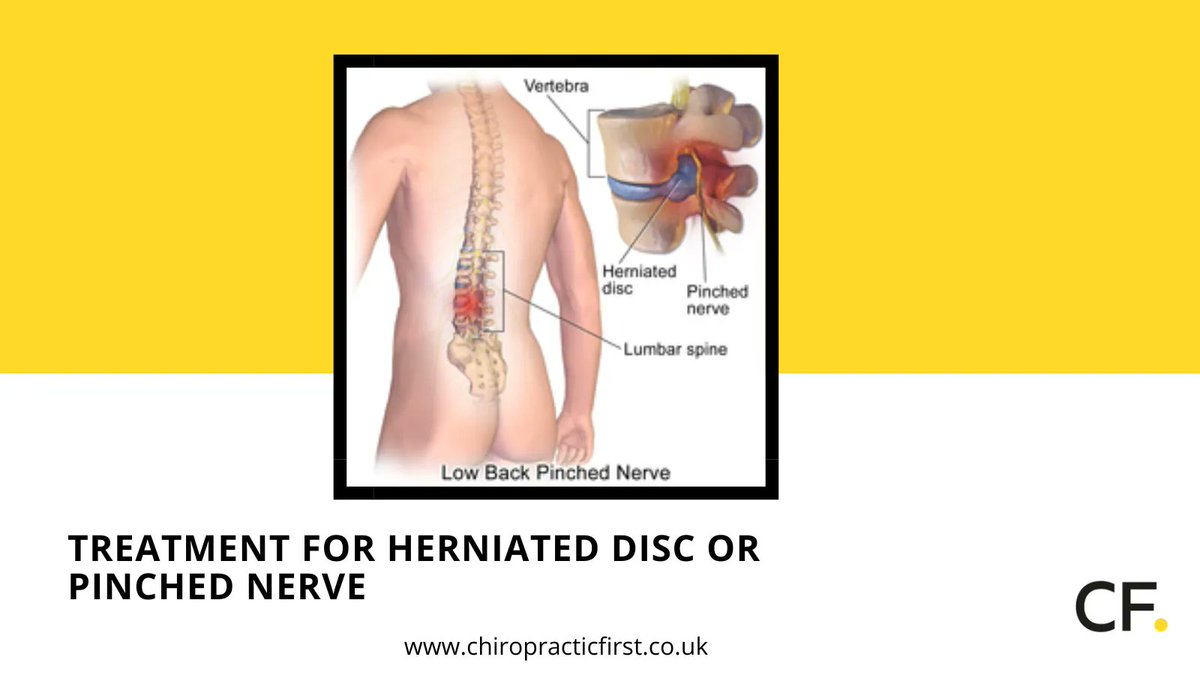 Don't let a herniated disc or pinched nerve hold you back any longer. Contact us today to schedule your appointment and start feeling better! Click the link here buff.ly/3Jt1qyk and go to our website.

#chiropracticfirst #chiropractorhove #hovechiropractic #HerniatedDisc