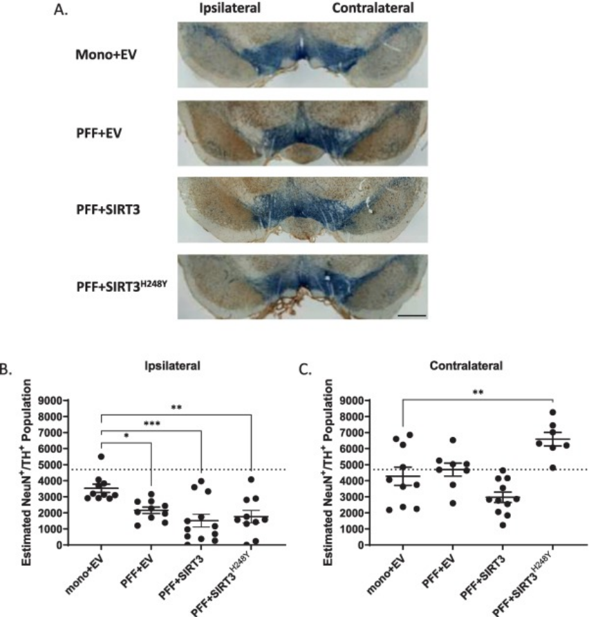 ScienceofPD's tweet photo. SIRT3 is negatively correlated with age &amp; phosphorylated Ser129 α-synuclein in human postmortem brains (#Parkinsons vs controls); In rats, a-synuclein pre-formed fibrils = neurodegeneration, but over-expression of SIRT3 reduces this
https://t.co/J47UCJIsjH https://t.co/NzWYE6RSXC