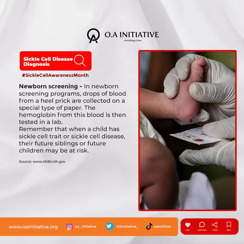 Day 14

Sickle Cell Diagnosis
Have you done a Genotype test?

Let's Keep saving lives and sharing awareness! 💫

#SickleCellAwarenessMonth #FightSickleCell