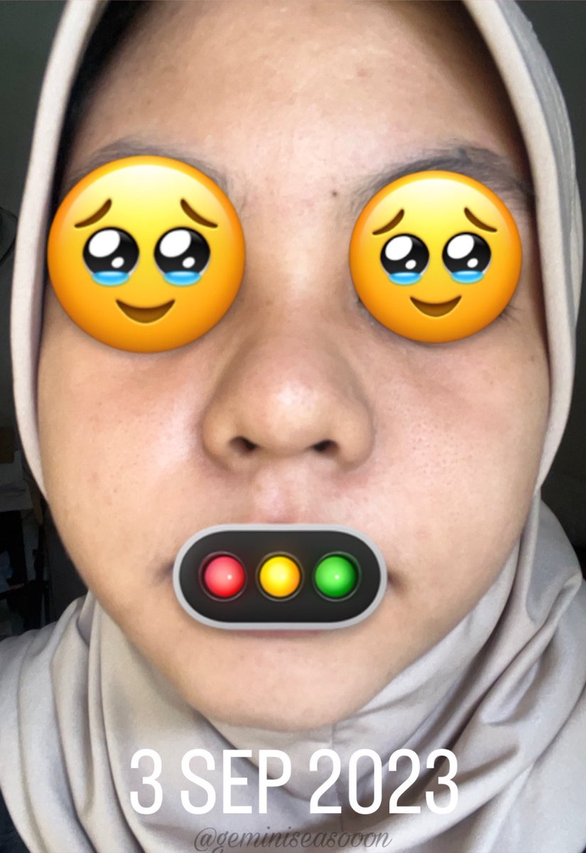 geminiseasooon's tweet photo. step,jadwal, dan produk yg aku pake buat skin cycling ⋆˚✿˖°

a thread

🪧 : based on my personal used ya (no edit2 club🙏)  dan tipe kulitku dry sensitive skin!

before                                     after https://t.co/pCO3fK2eCf