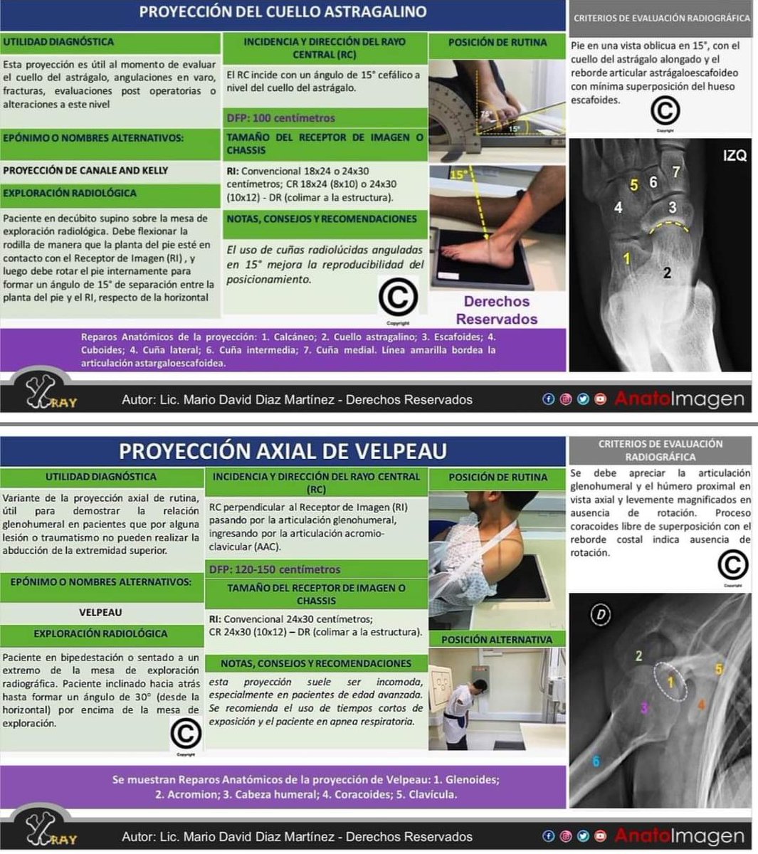 Proyecciones no muy habituales en las imágenes de #Radiología con su explicación para los #TecnicosRadiología #TecnicoRadiología #TSID que son muy de utilidad en su trabajo del día a día 🩻🏥☢️