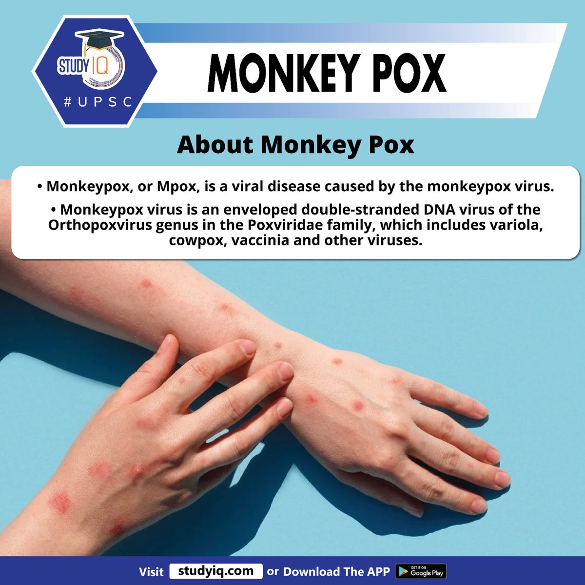 upsciq's tweet photo. Monkey Pox

#monkeypox #worldhealthorganization #WHO #globalhealthemergency #whyinnews #mankeypoxvirus #dna #dnavirus #cowpox #throat #headache #upsc #cse #ips #ias #worldaffairs https://t.co/gN7QXMMsn0