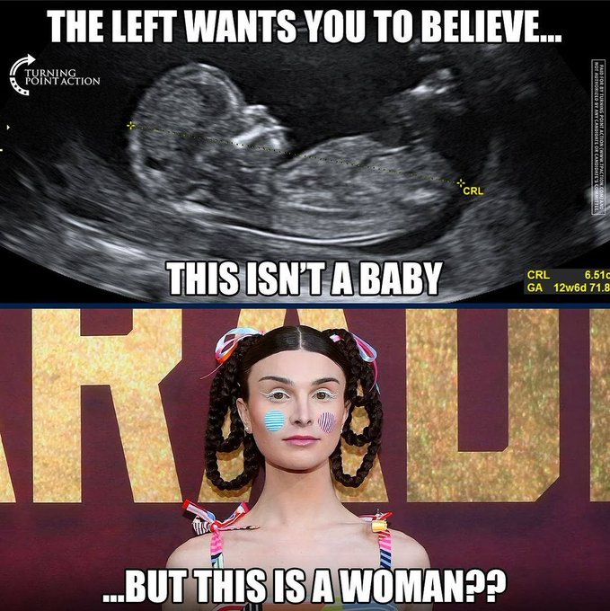 •Ɛɱɱყ• (@brixwe) on Twitter photo 