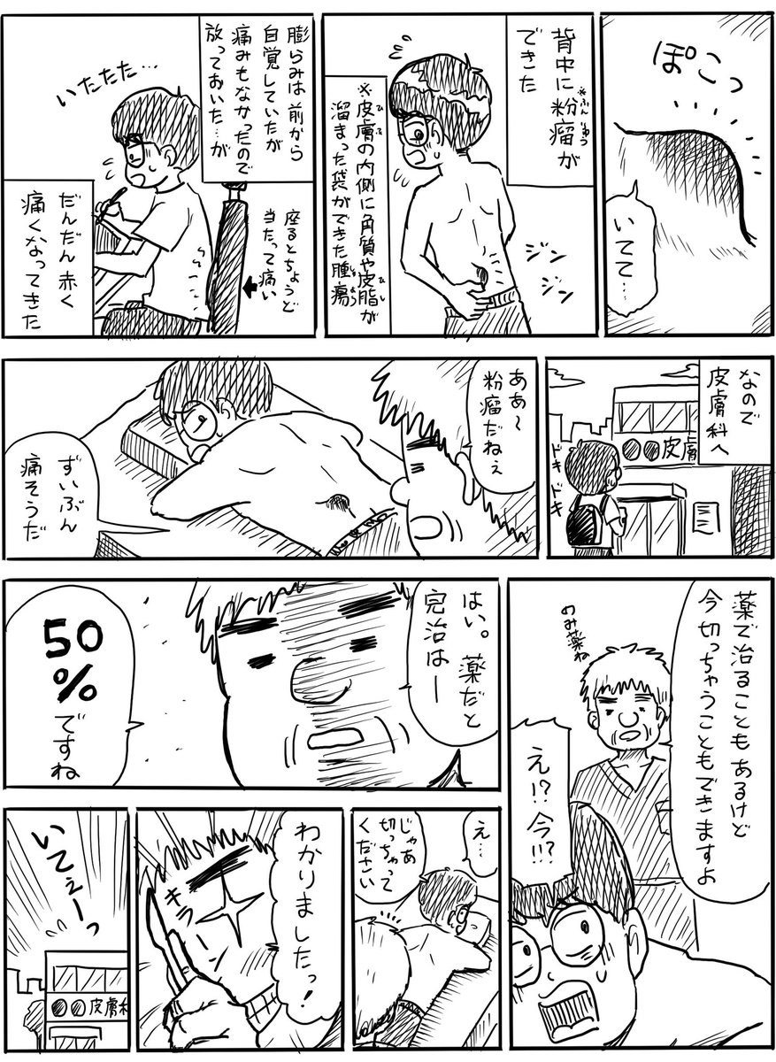 粉瘤(良性腫瘍)が背中にできて切った結果…(1/2)

#漫画が読めるハッシュタグ
#マンガが読めるハッシュタグ 