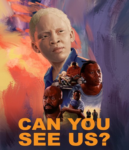 Sightsavers tweet media