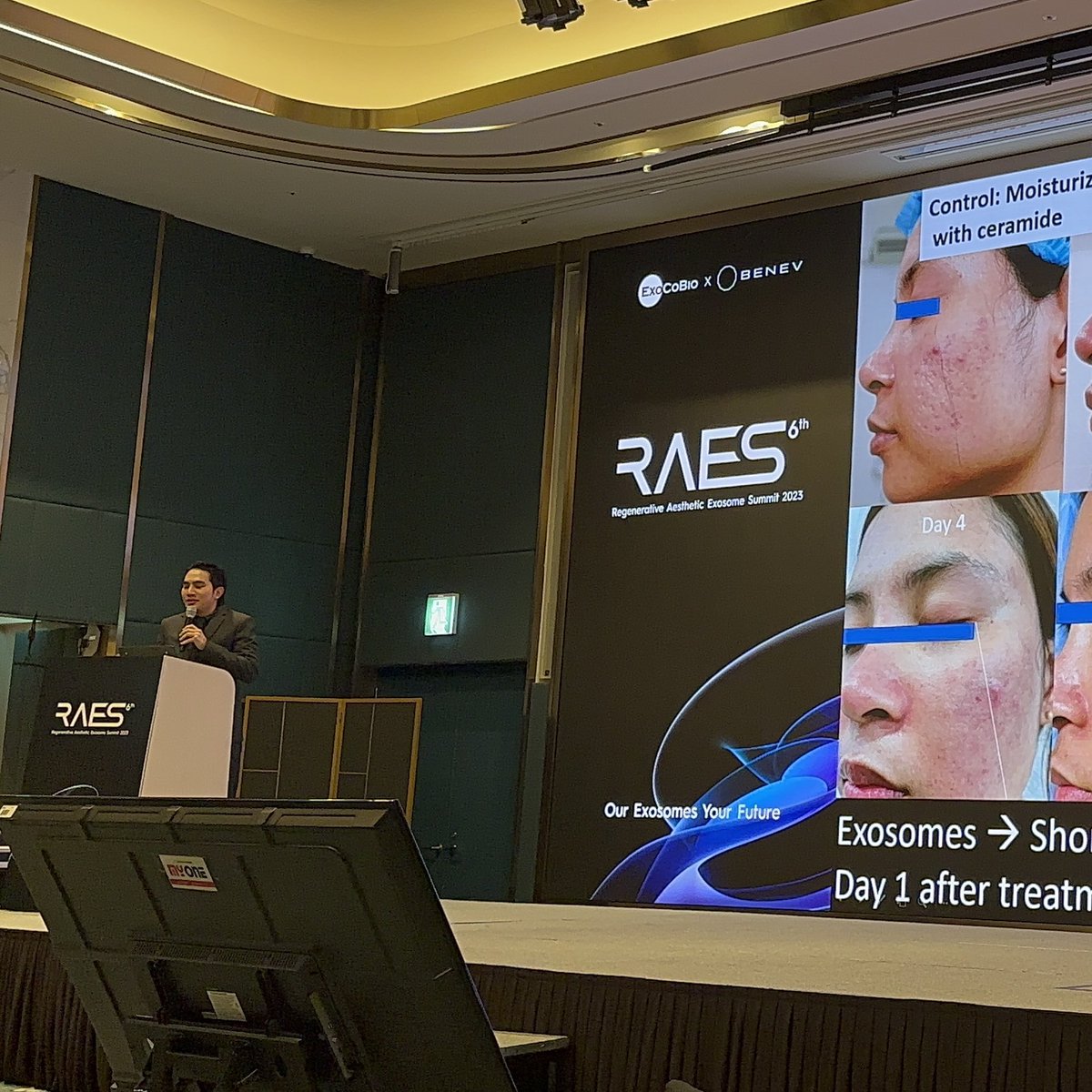 DrSuparuj's tweet photo. INTERNATIONAL EXOSOMES Conference AWARD 6thRAES 
RAES Exosome Award: CLINICAL CASE Award 

#exosomes #exosomestherapy #intimatecare #exocobio #exocobioexosomes #raes2023 #drsuparuj #demedclinic #หมอรุจชวนคุย https://t.co/u31mzJWflL