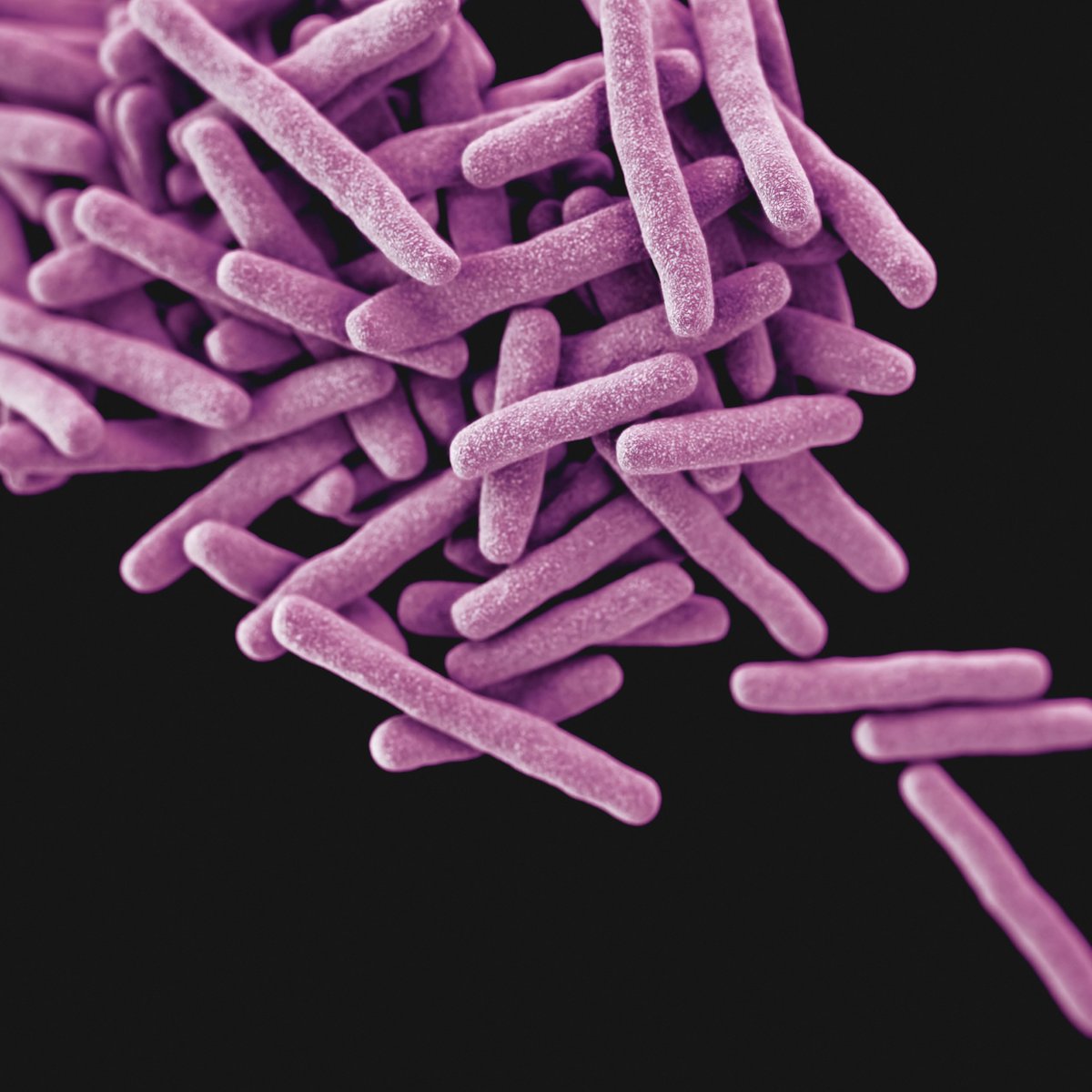 In a population-based cohort study, Eveline Klinkenberg and colleagues examine the impact of the PopART intervention on TB prevalence in Zambia and South Africa: doi.org/10.1371/journa… @ZambartResearch <a href="/TheUnion_TBLH/">The Union</a> <a href="/EDCTP/">EDCTP</a> <a href="/LSHTM_TB/">LSHTM TB Centre</a> <a href="/ISEG_LSHTM/">International Statistics and Epidemiology Group</a> @ScHARRSheffield <a href="/EKlinkenberg/">Eveline Klinkenberg</a>