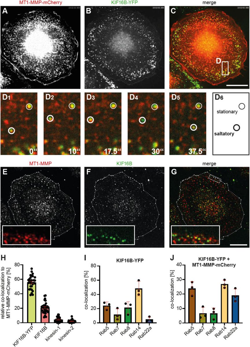 LifeScienceAlliance (@lsajournal) on Twitter photo Hey et al. show that KIF16B-dependent recycling of MT1-MMP to the surface of primary macrophages impacts on macrophage invasion, & also on co-invasion of cancer cells, pointing to a likely role of KIF16B in the tumor microenvironment <a href="/UKEHamburg/">UKE Hamburg</a> <a href="/linderlab/">The Linder Lab</a> bit.ly/45NcrEW Hey et al. show that KIF16B-dependent recycling of MT1-MMP to the surface of primary macrophages impacts on macrophage invasion, & also on co-invasion of cancer cells, pointing to a likely role of KIF16B in the tumor microenvironment <a href="/UKEHamburg/">UKE Hamburg</a> <a href="/linderlab/">The Linder Lab</a> bit.ly/45NcrEW