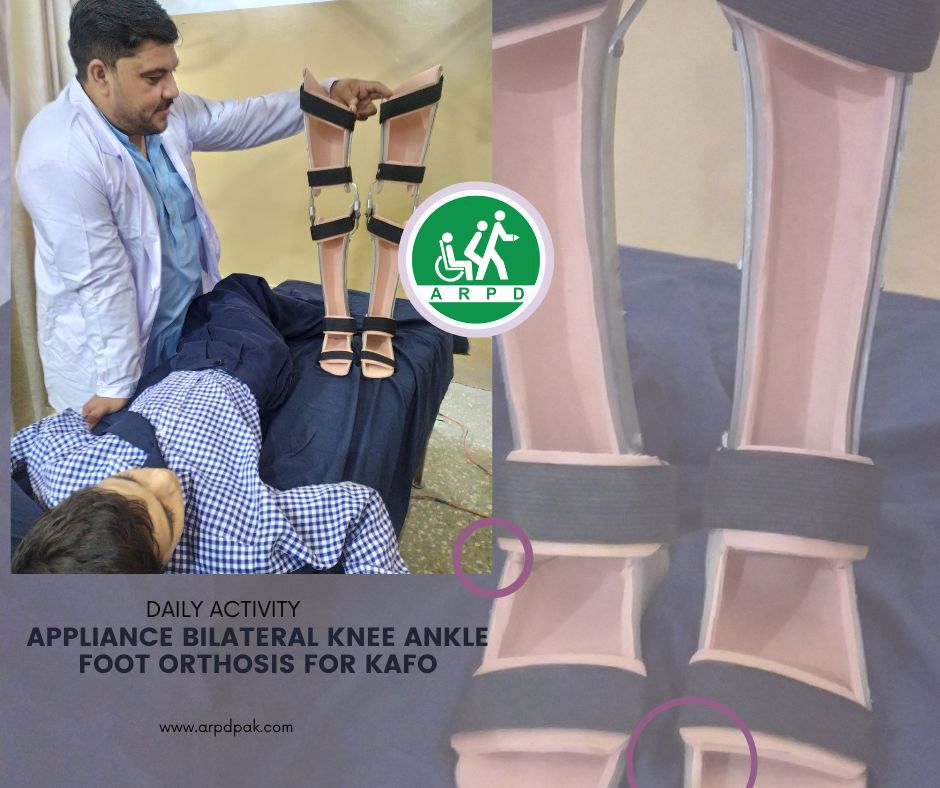 HHCSARPD's tweet photo. Daily Activity
(Appliance Bilateral Knee Ankle foot Orthosis for KAFO)
Association for the Rehabilitation of the Physically Disabled
#arpd #physioterapy #peshawar #rcpd #helpingothers #helpinghearts #rehabilitation #skillsdevelopment #SkillsForLife #skills https://t.co/yHdTeSfmcM