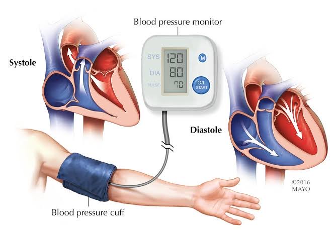 BP may increase in the short-term (immediately after drinking coffee), similar to what happens after running, weightlifting or having sexual intercourse; however, in the long run, coffee has beneficial effects on BP (lowers BP) just like running.
#Bloodpresure