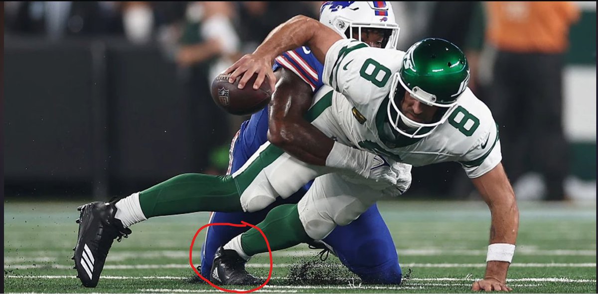 Damn, I can't believe Rodgers got a season ender like that. Rewatched the play and it totally makes sense this his achilles popped.

I'm not the epitome of flexibility but I sure know that my foot can't bend that far.