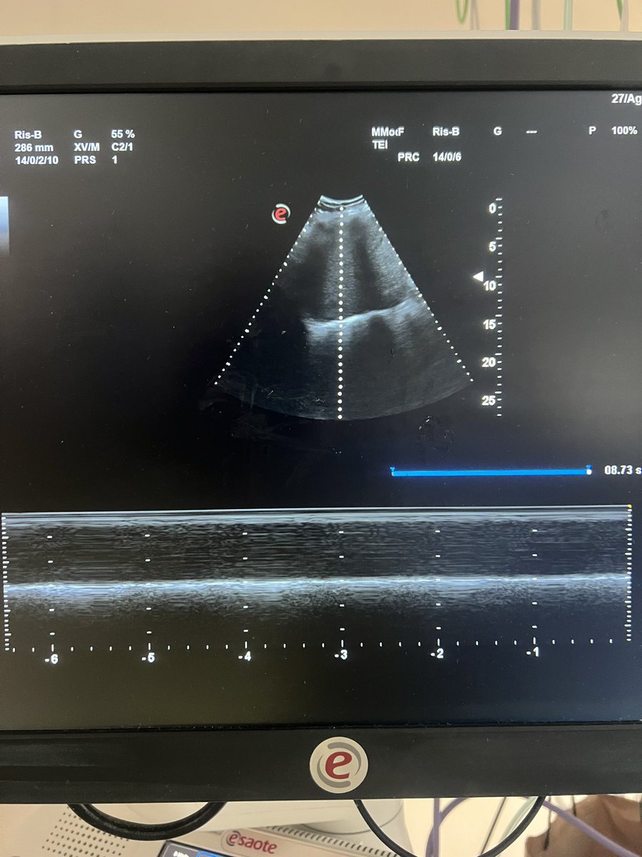 Mauro Pavone, M.D. tweet media