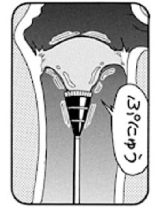 【トリコトリビア】
次郎が小松の鼓膜治すシーン、縦にするとなんかエロい。 