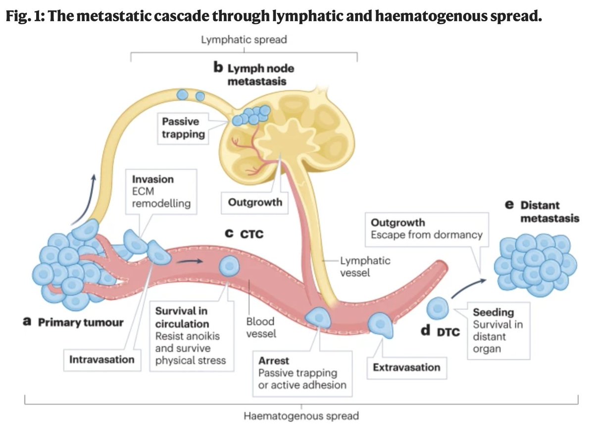 SCI member @LabWinslow explores key variables in designing assays for studying #metastasis, preclinical models, and potential anti-metastatic therapies. bit.ly/3K3EJ5y