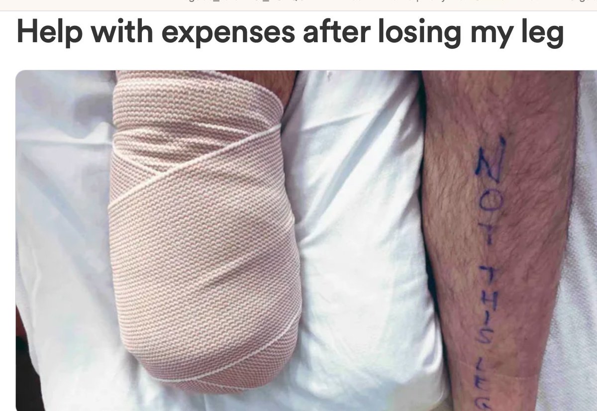 janiesaysyay's tweet image. 2022 Inoperable cl0t, amputation. &amp;gt;
#CorrelationNotCausation