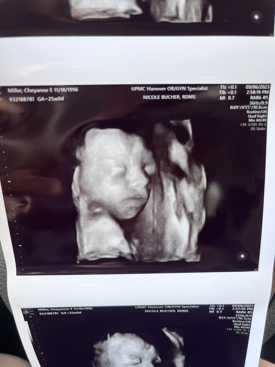 Do I look like mommy or daddy ? #baby #WhatDoYouThink  #pregnancy