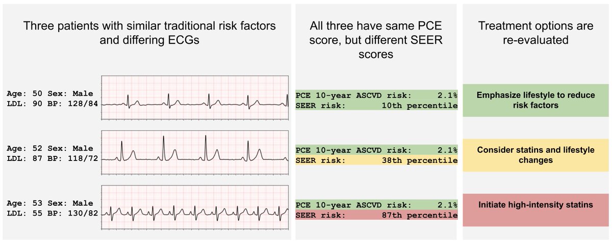 Excited to share the Stanford Estimator of Electrocardiogram Risk (SEER), an AI risk score based on the ECG, out today in @npjDigitalMed with Marco Perez @james_y_zou @euanashley @David_Ouyang @PierreEliasMD and many others! @StanfordDBDS @CedarsSinaiMed @ColumbiaCardio 1/n