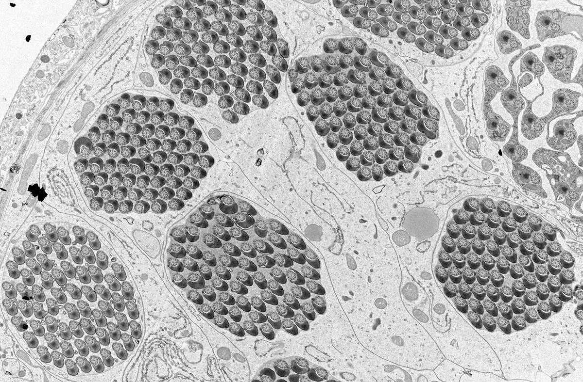 A high-res look inside the testes of a fruit fly for <a href="/lizzyzhao/">Li Zhao</a>’s lab. Each sac contains 64 sperm. Rockefeller's Electron Microscopy Resource Center used the diamond blade of an Ultramicrotome tool to create slices 1000x thinner than a sheet of paper. #bioscience #sciart